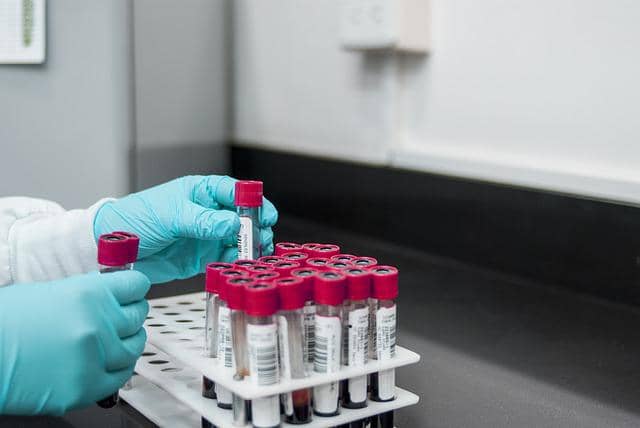Testing for HIV in a lab